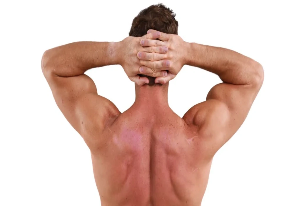 درمان قوز کمر با ورزش