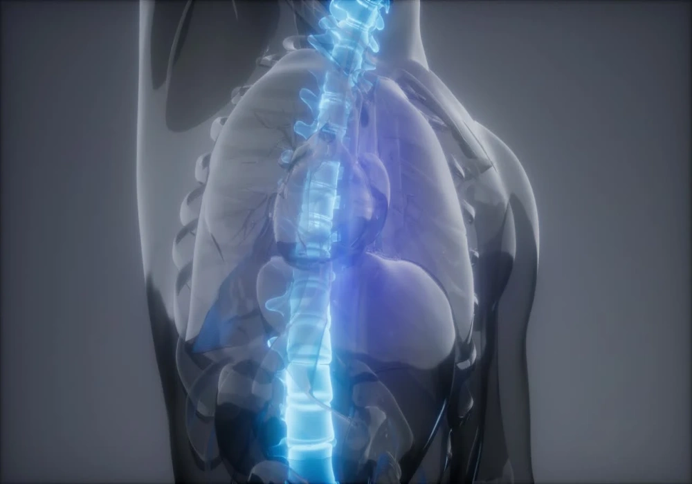 قوز کمر چیست؟